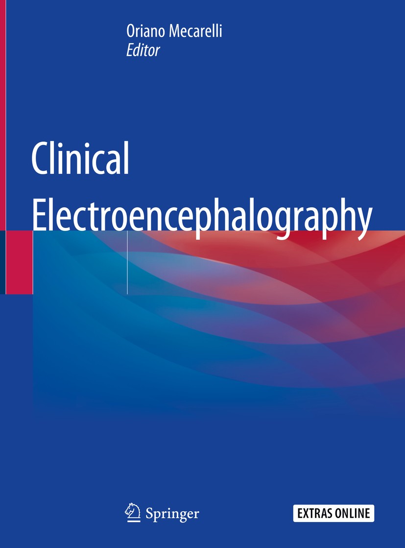 Clinical Electroencephalography | SpringerLink