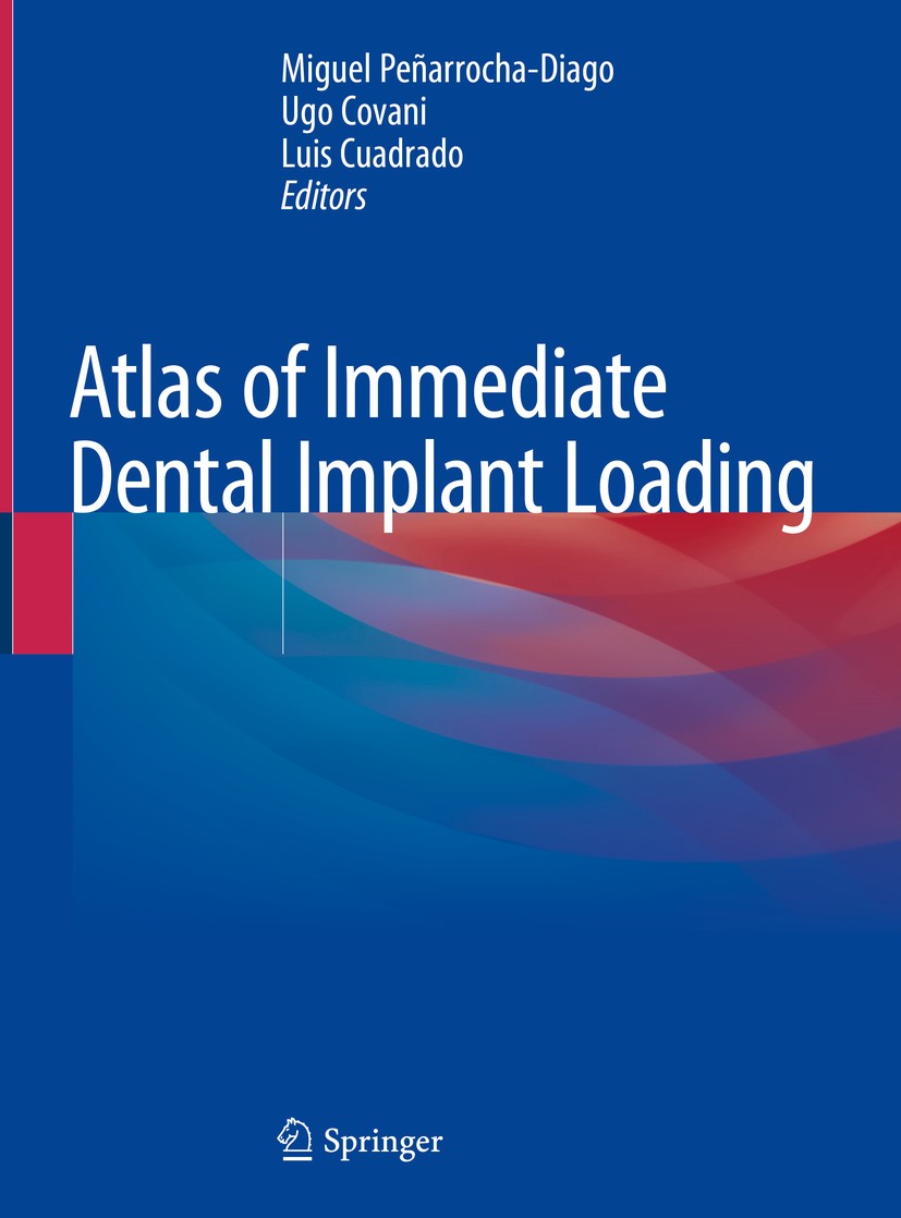 Atlas of Immediate Dental Implant Loading | Springer Nature Link