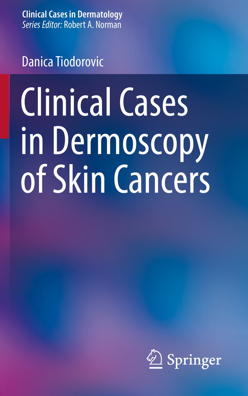 Clinical Cases in Dermoscopy of Skin Cancers | SpringerLink