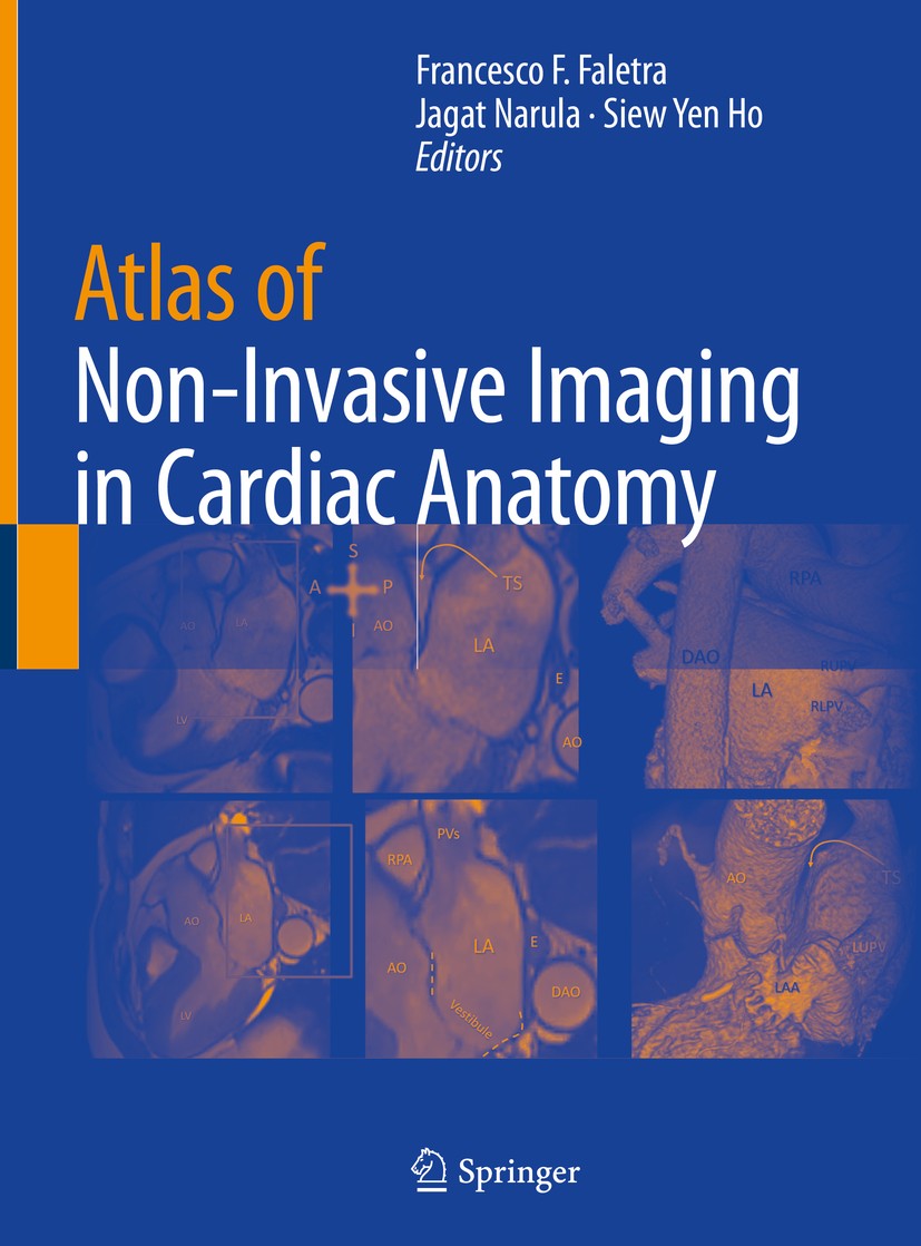 Atlas of Non-Invasive Imaging in Cardiac Anatomy | SpringerLink