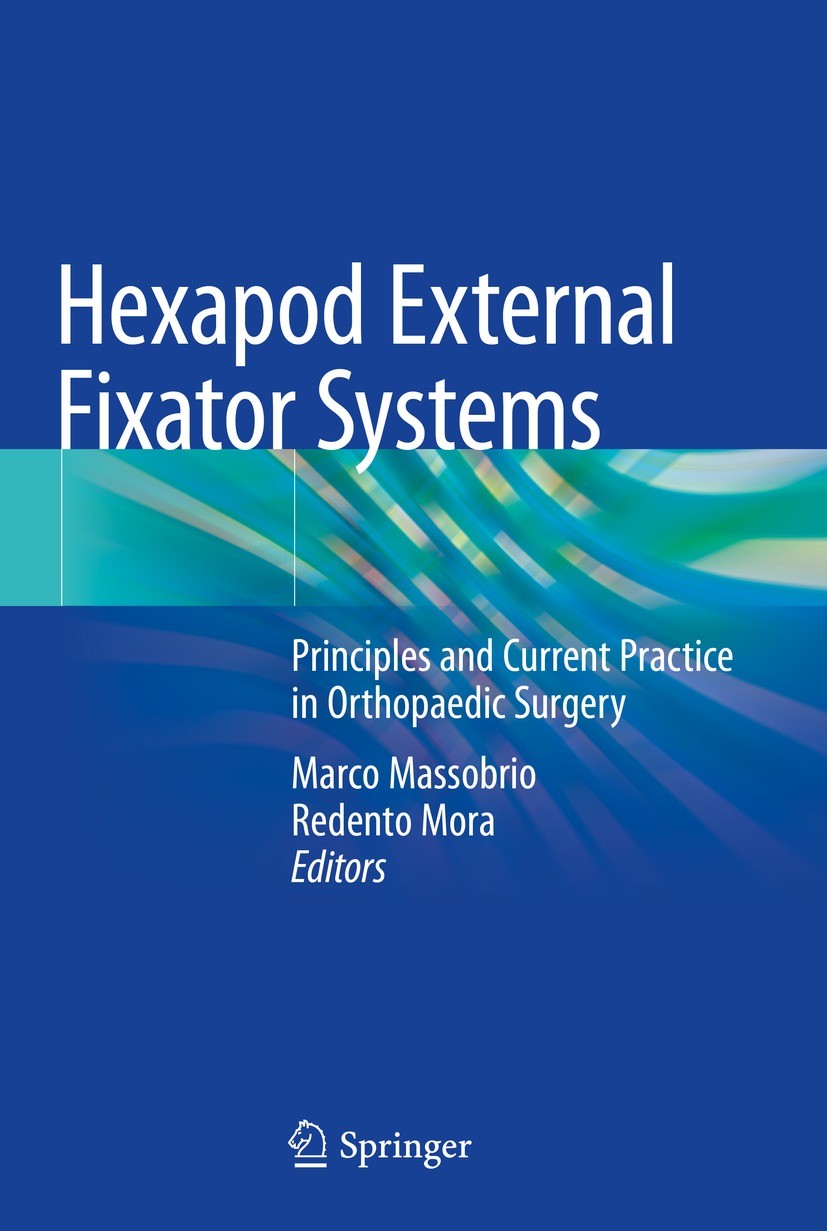 Hexapod External Fixators in Bone Defect Treatment | SpringerLink