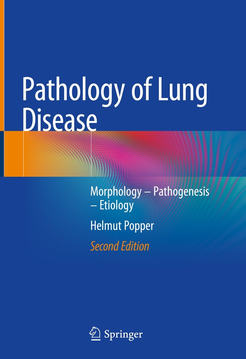 Lung Tumors | SpringerLink