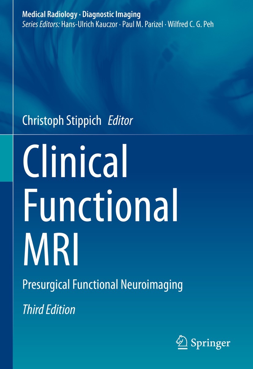 Task-Based Presurgical Functional MRI in Patients with Brain Tumors |  SpringerLink