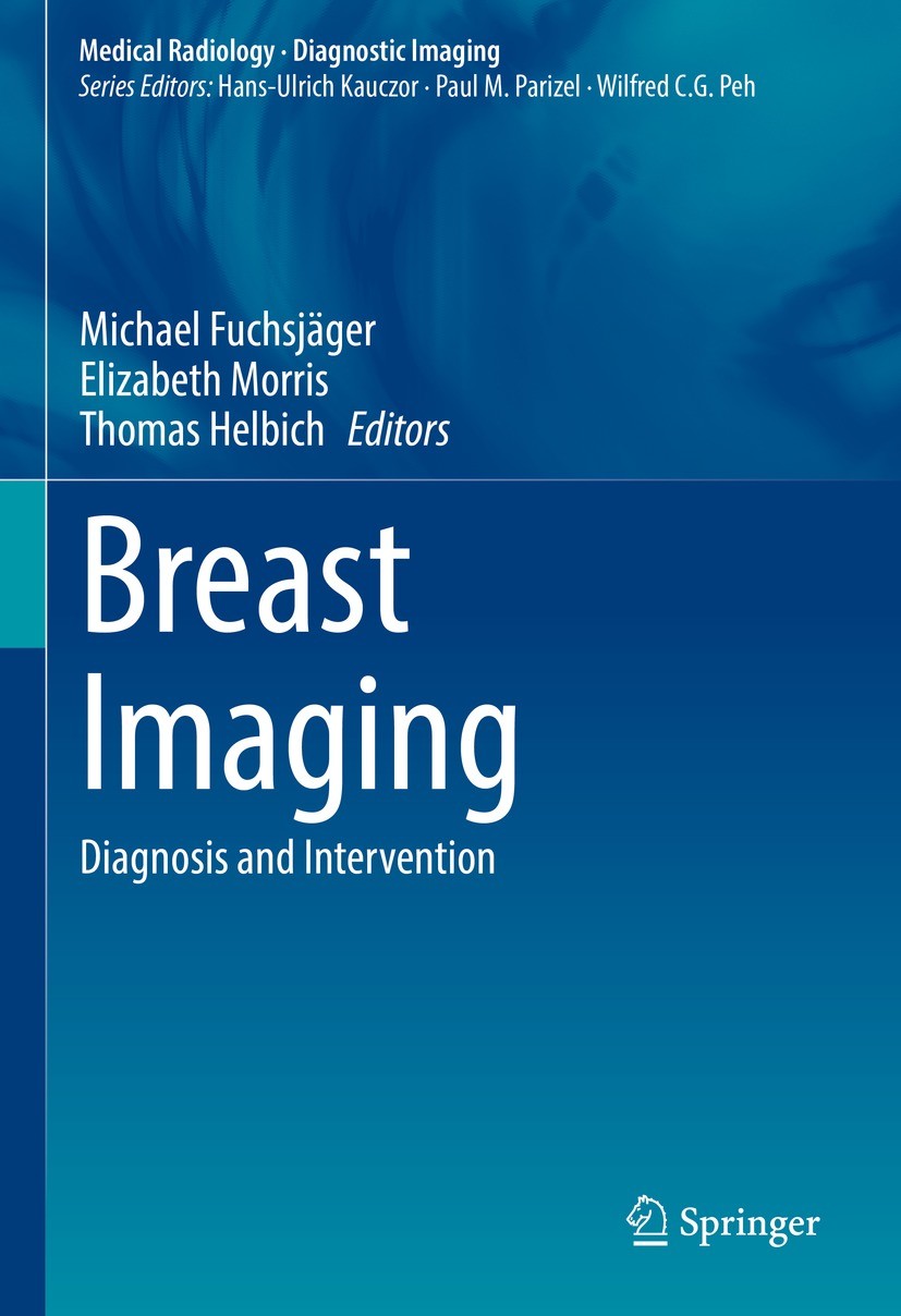 Breast MRI: Techniques and Indications | SpringerLink
