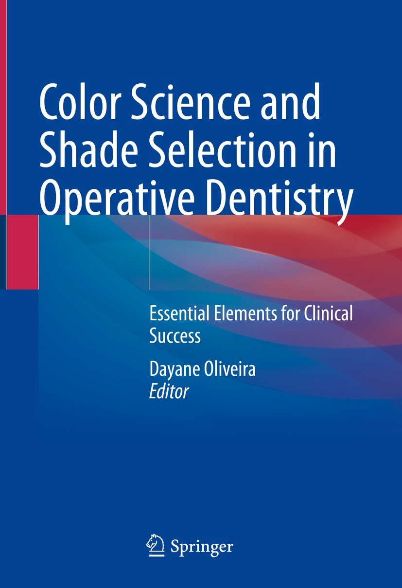 Longevity of Resin Composite Restorations | SpringerLink