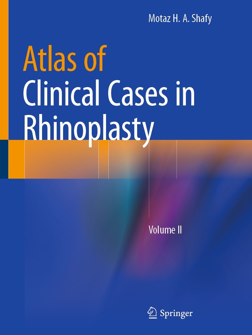 健康・医学 atlas of asian rhinoplasty 健康・医学 atlas of asian
