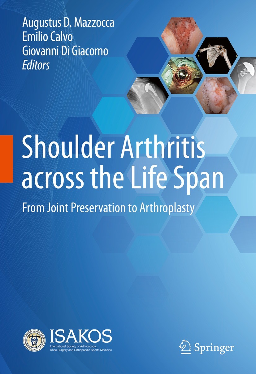 Shoulder Arthritis  Johns Hopkins Medicine