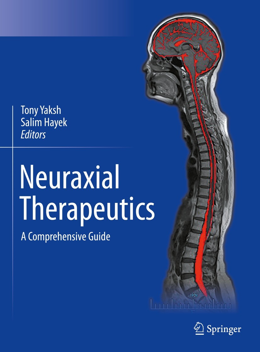 Neuraxial Therapeutics: A Comprehensive Guide | SpringerLink