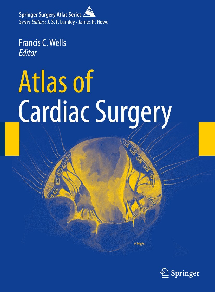 Khonsari's Cardiac Surgery: Safeguards and Pitfalls in