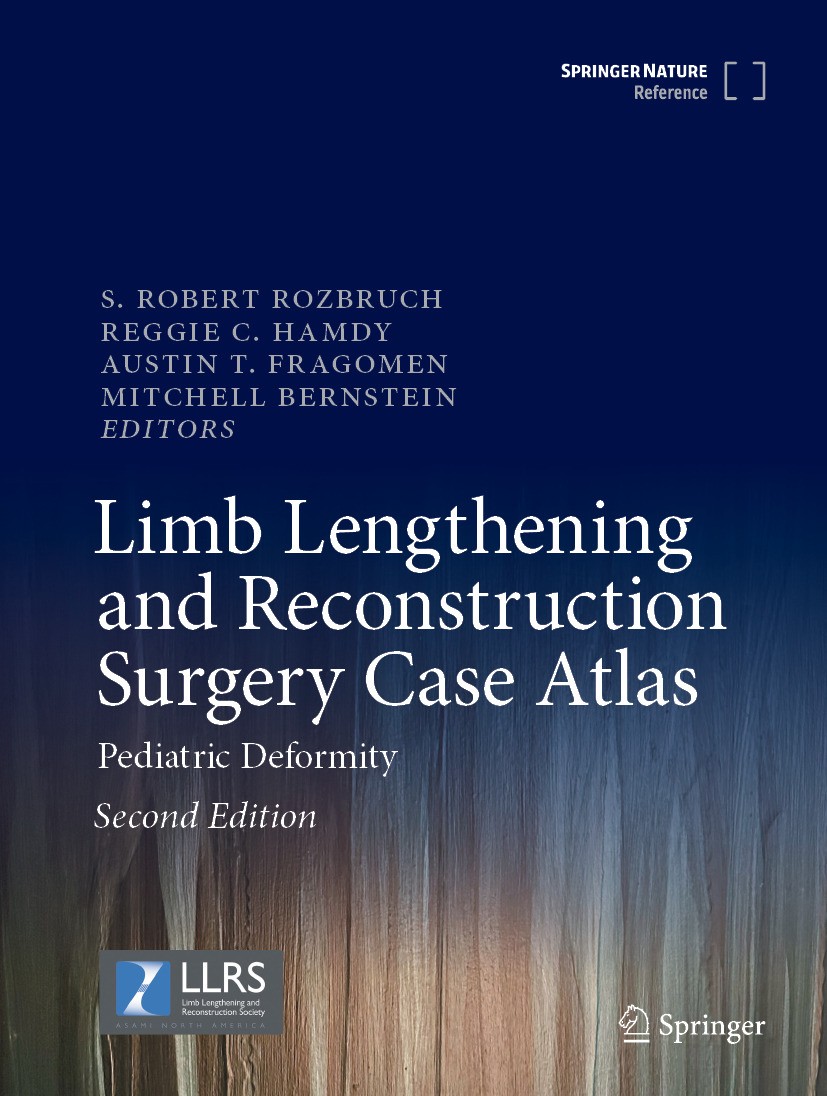 Limb Lengthening and Reconstruction Surgery Case Atlas Limb Lengthening and Reconstruction Surgery Case Atlas
