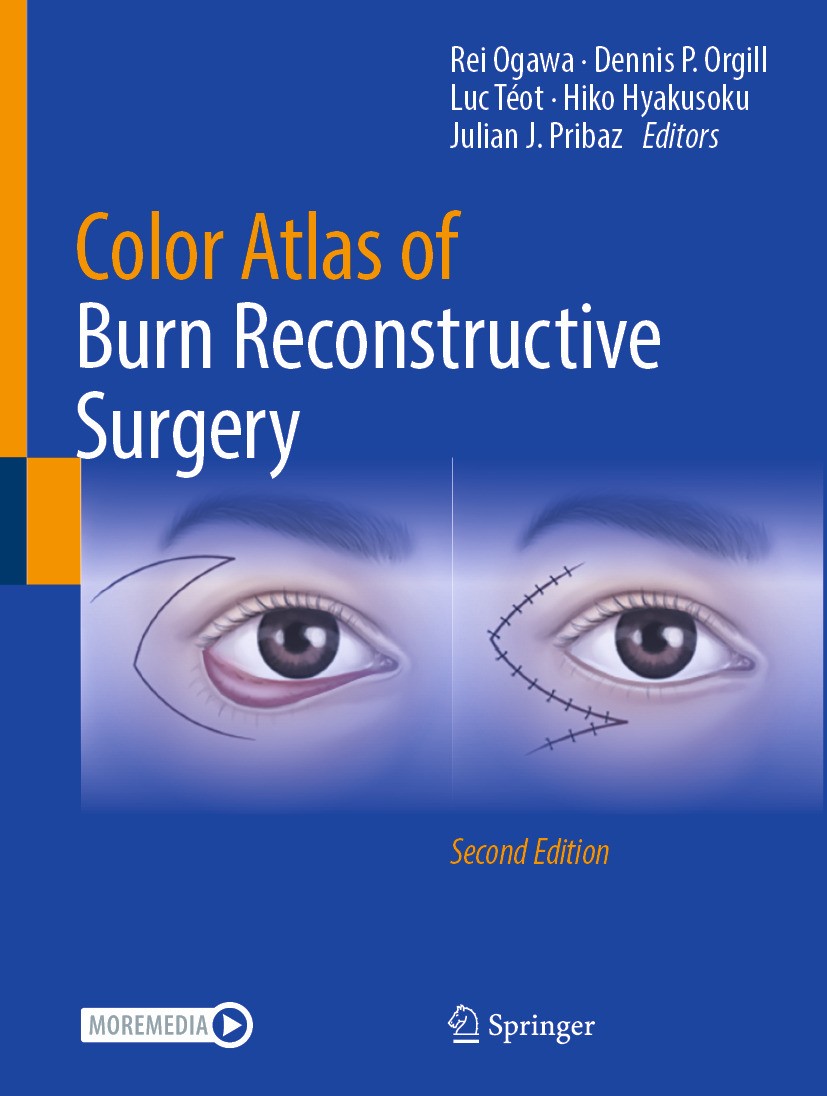 Color Atlas of Burn Reconstructive Surgery | SpringerLink