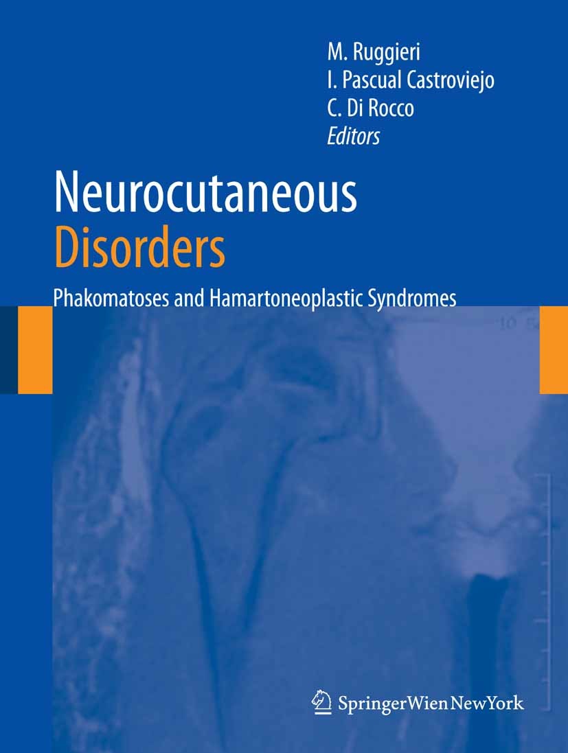 Neurofibromatosis type 1 & Related Disorders | SpringerLink
