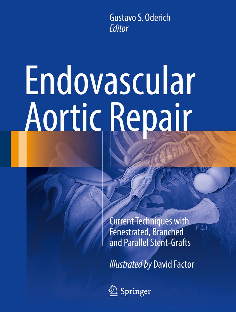 Lightbox view of the cover for Endovascular Aortic Repair