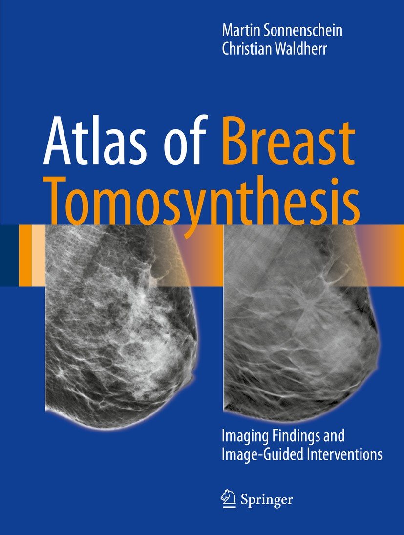 健康・医学 Atlas of Breast Surgical Techniques Atlas of Breast Surgical Techniques A Volume in the Surgical