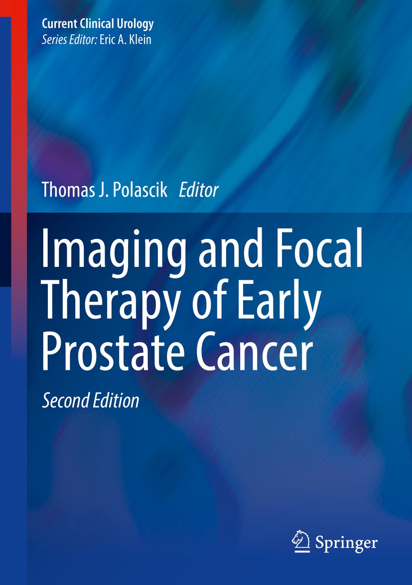 Imaging and Focal Therapy of Early Prostate Cancer | SpringerLink