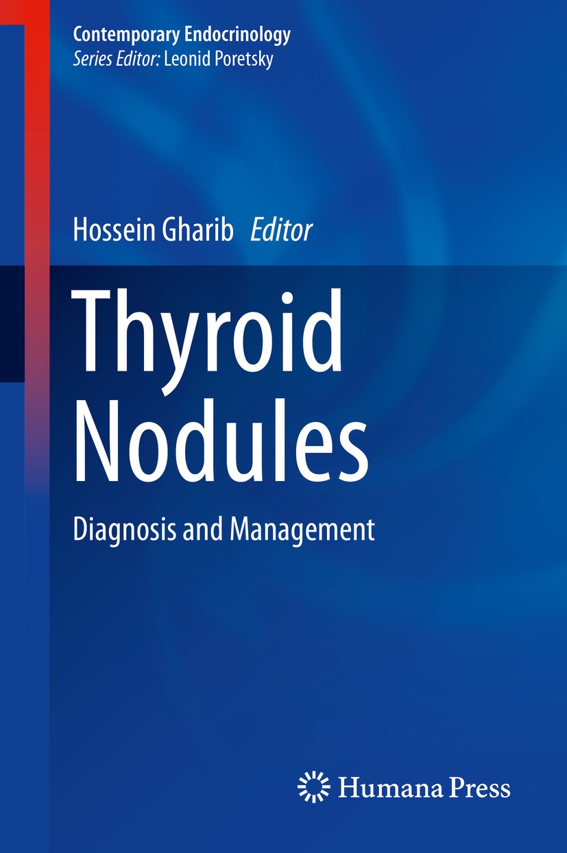 Thyroid Nodules: Diagnosis and Management | SpringerLink