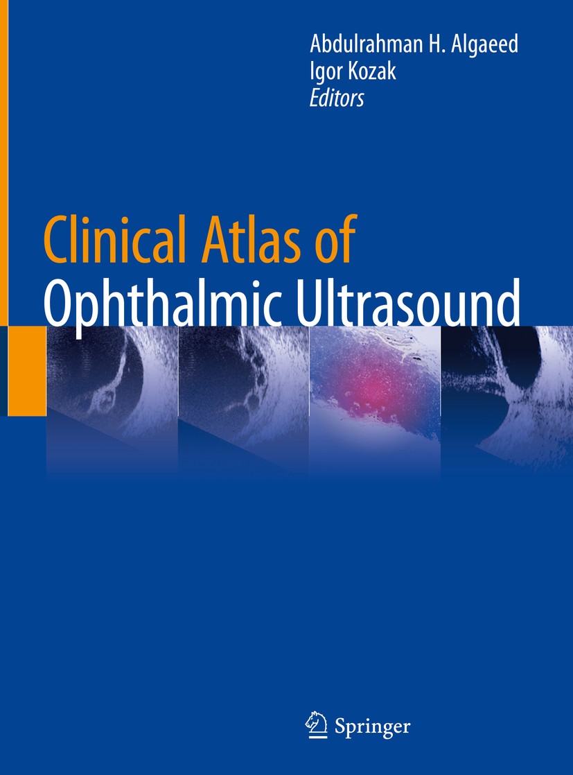 Clinical Atlas of Ophthalmic Ultrasound | SpringerLink
