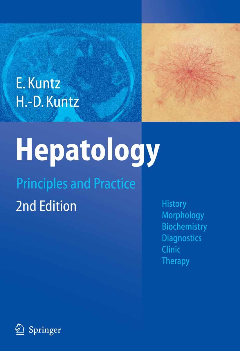 Hepatology, Principles and Practice: History, Morphology, Biochemistry, Diagnostics, Clinic, Therapy | SpringerLink Hepatology, Principles and Practice: History, Morphology, Biochemistry, Diagnostics, Clinic, Therapy | SpringerLink