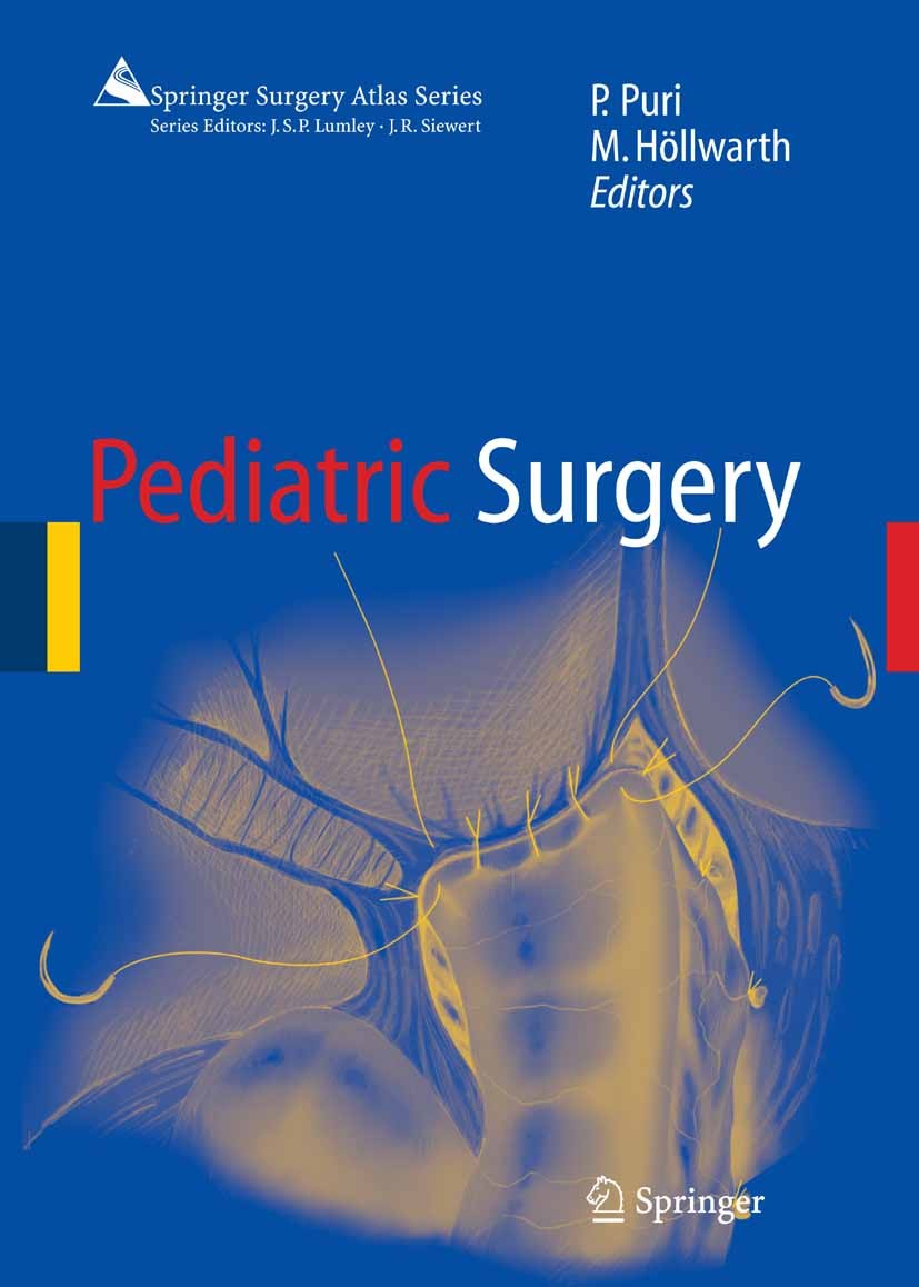 Pediatric Surgery | SpringerLink Pediatric Surgery | SpringerLink