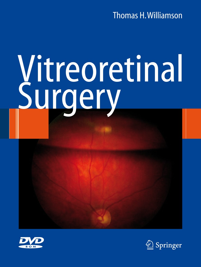 Vitreoretinal Surgery | SpringerLink Vitreoretinal Surgery | SpringerLink