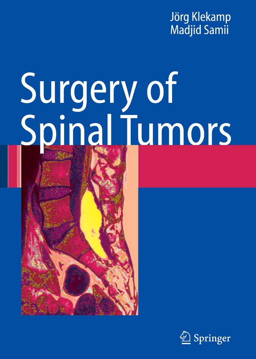Surgery of Spinal Tumors | SpringerLink