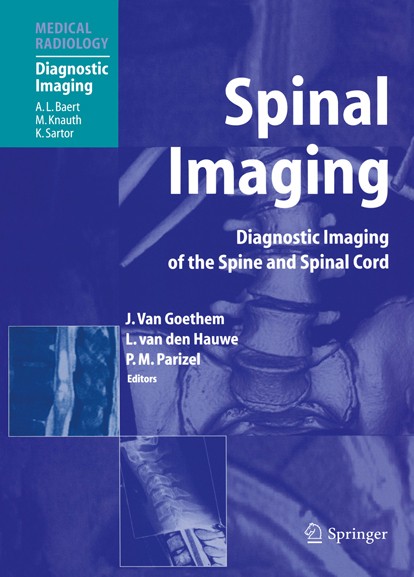 Spinal Imaging: Diagnostic Imaging of the Spine and Spinal