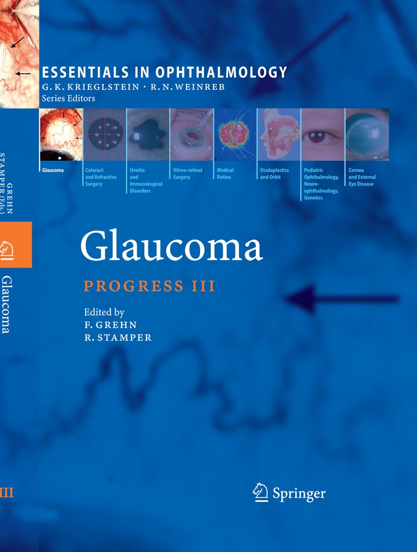 GLAUCOMA 第2版 volume 2のみ Glaucoma: 2-Volume Set: 9780702051937: Medicine & Health