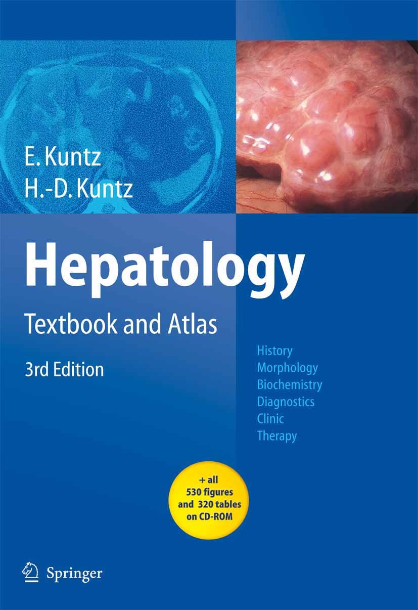 Hepatology: Textbook and Atlas | SpringerLink Hepatology: Textbook and Atlas | SpringerLink