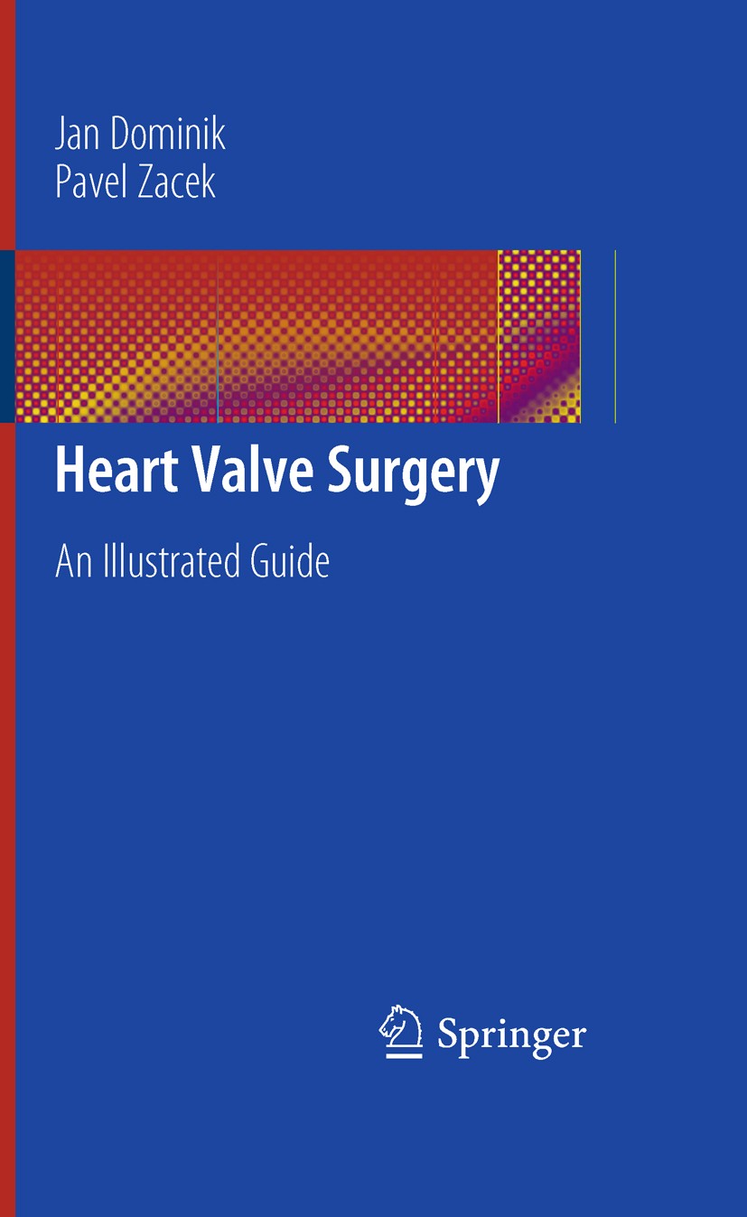 Heart Valve Surgery: An Illustrated Guide | SpringerLink