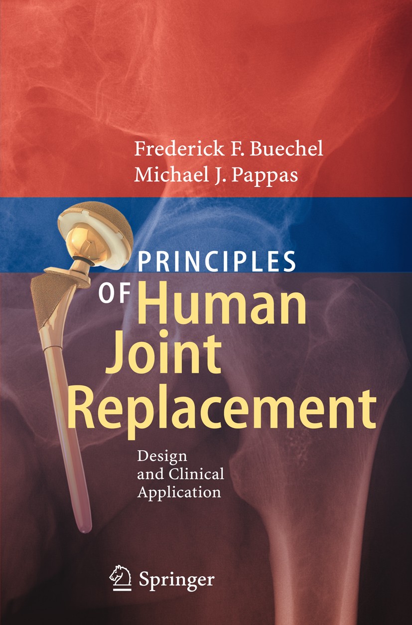 Application　Replacement:　Human　Clinical　and　Design　Joint　of　Principles　SpringerLink