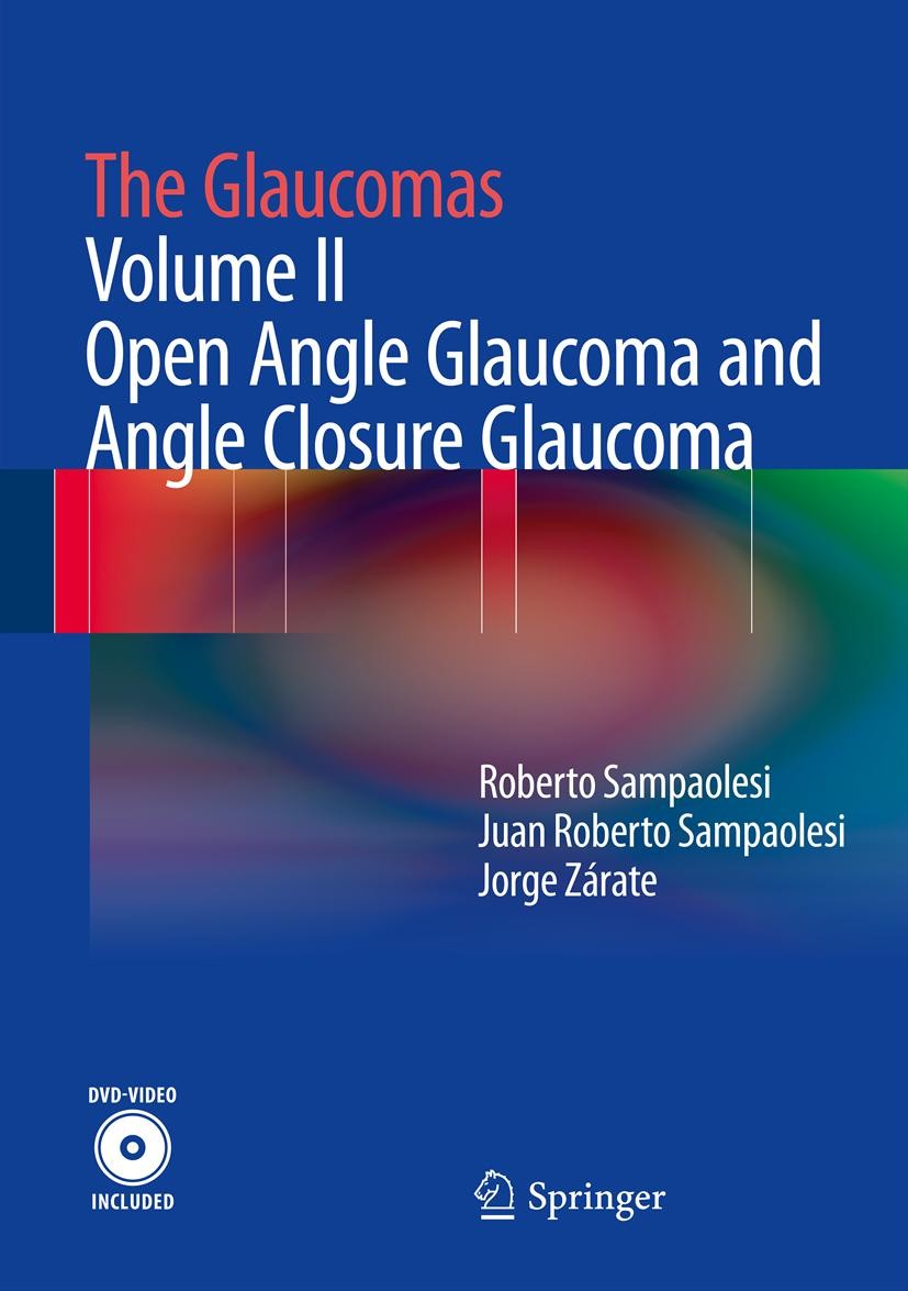 The Glaucomas: Volume II - Open Angle Glaucoma and Angle