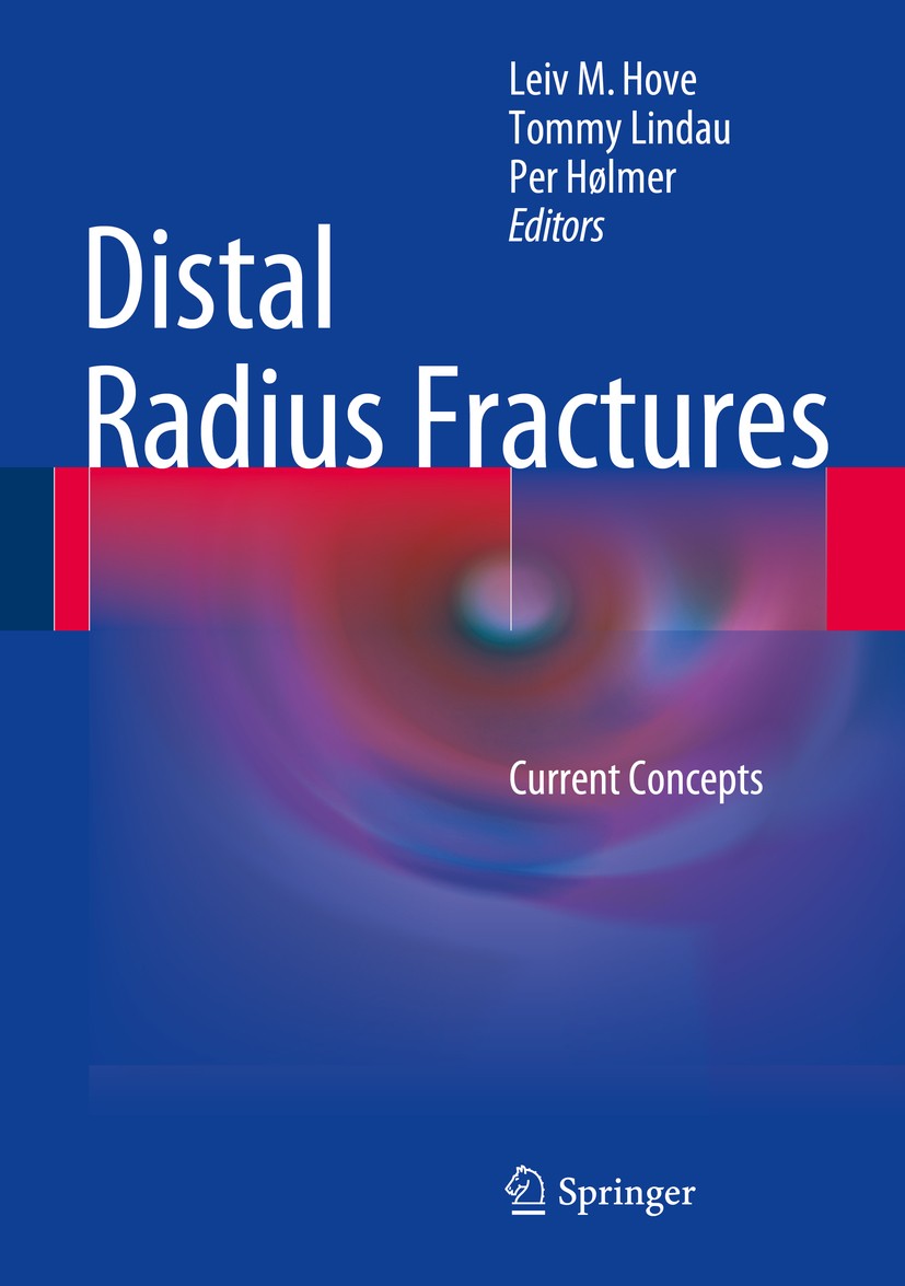 健康・医学 Distal Radius Fractures and Carpal Distal Radius Fractures and Acute Carpal Tunnel Syndrome