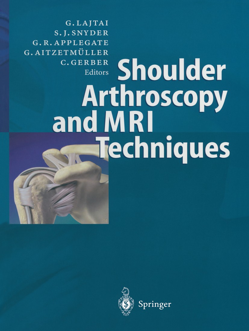 Shoulder Arthroscopy and MRI Techniques | SpringerLink