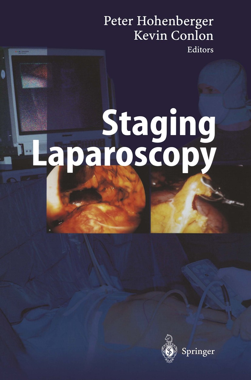 Staging Laparoscopy | SpringerLink Staging Laparoscopy | SpringerLink