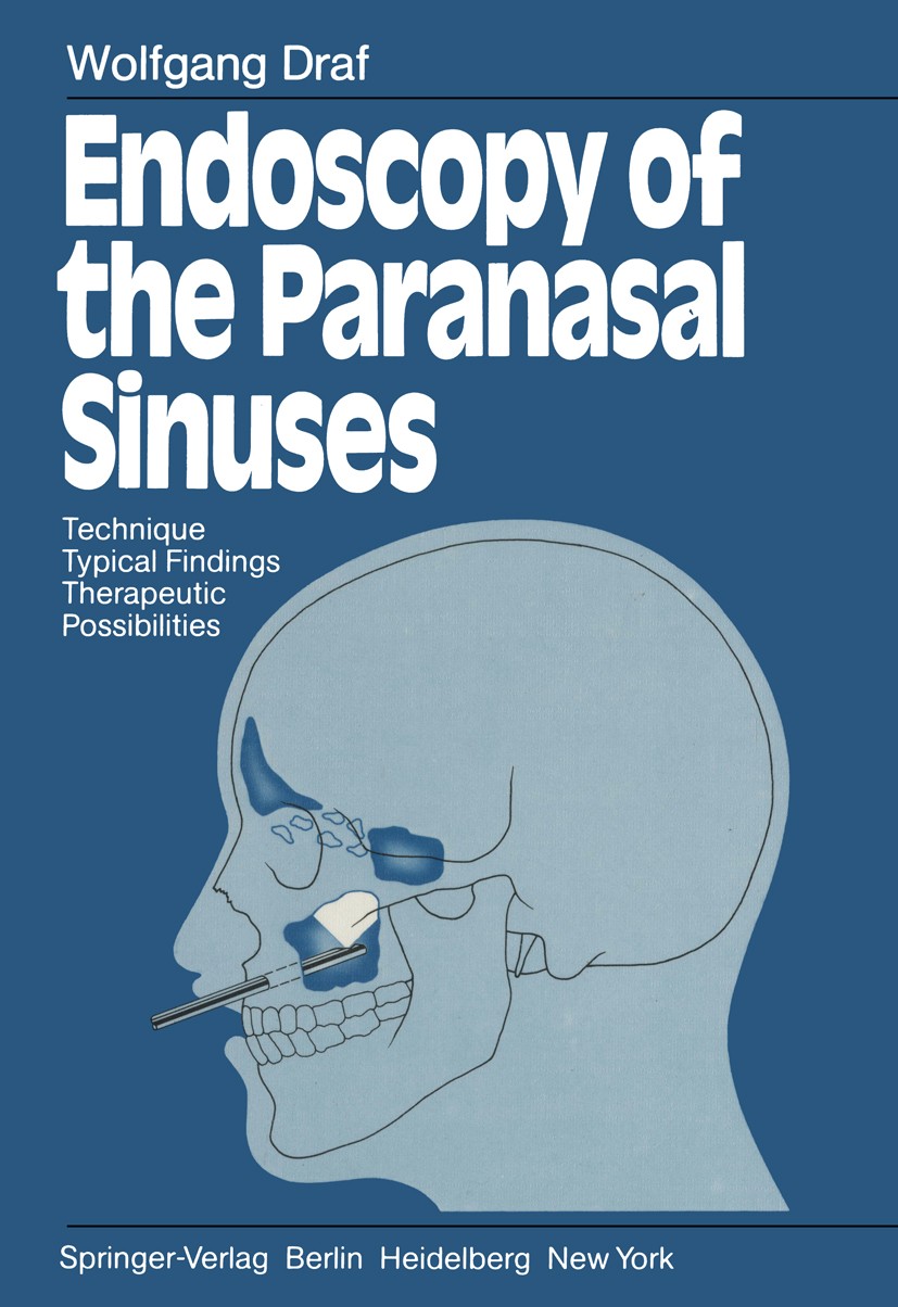 Sphenoid sinusitis 2024 neurological symptoms