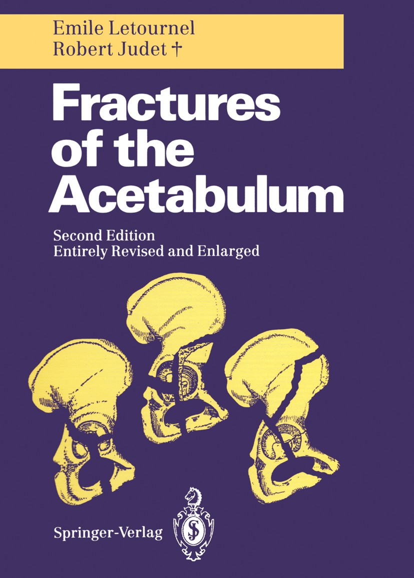 健康・医学 Fractures of the Acetabulum Fractures of the Acetabulum | SpringerLink