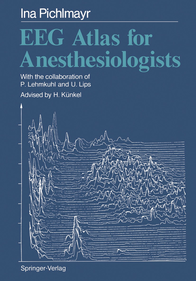 EEG Atlas for Anesthesiologists | SpringerLink