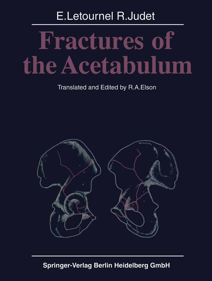 Fractures of the Acetabulum | SpringerLink