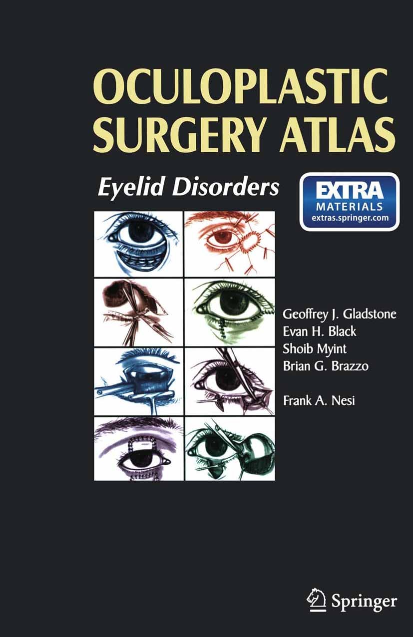 【美品】Atlas of Oculoplastic and Orbital Atlas of Oculoplastic and Orbital Surgery: 9781496390813