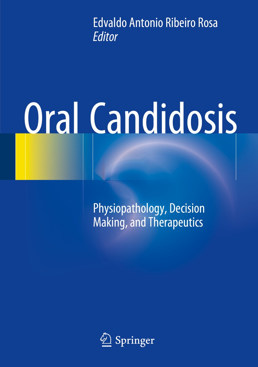 Oral Candidosis: Physiopathology, Decision Making, and Therapeutics |  Springer Nature Link