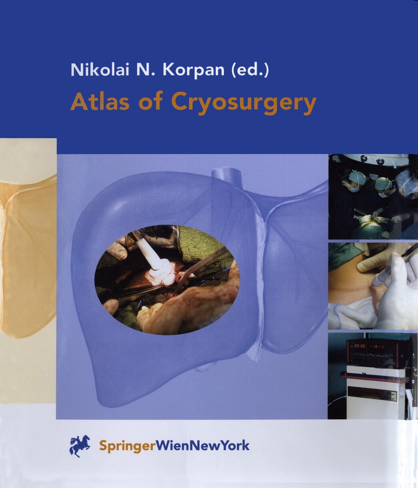 Atlas of Cryosurgery | SpringerLink Atlas of Cryosurgery | SpringerLink