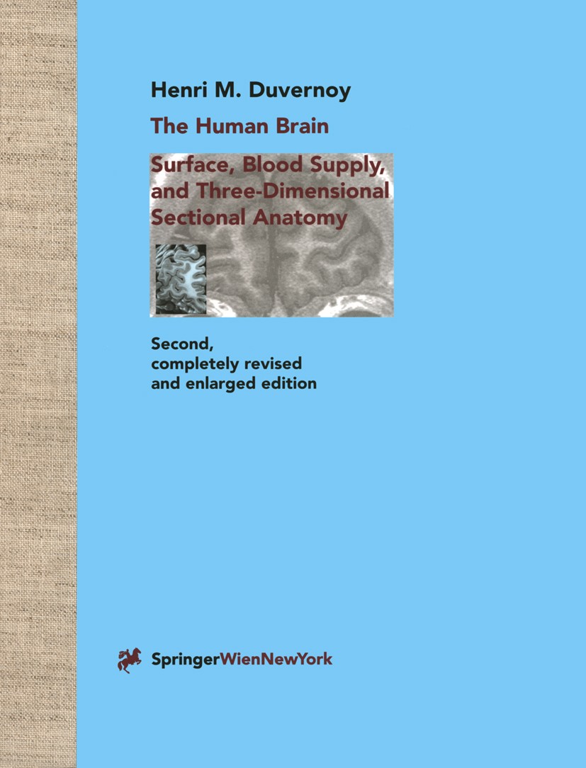 The Human Brain: Surface, Three-Dimensional 2nd Ed by Henri