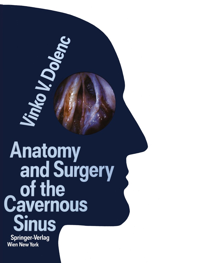 洋書 Anatomy and Surgery of the Cavernous Sin Cavernous Sinus - Location, Drainage & Function - Human