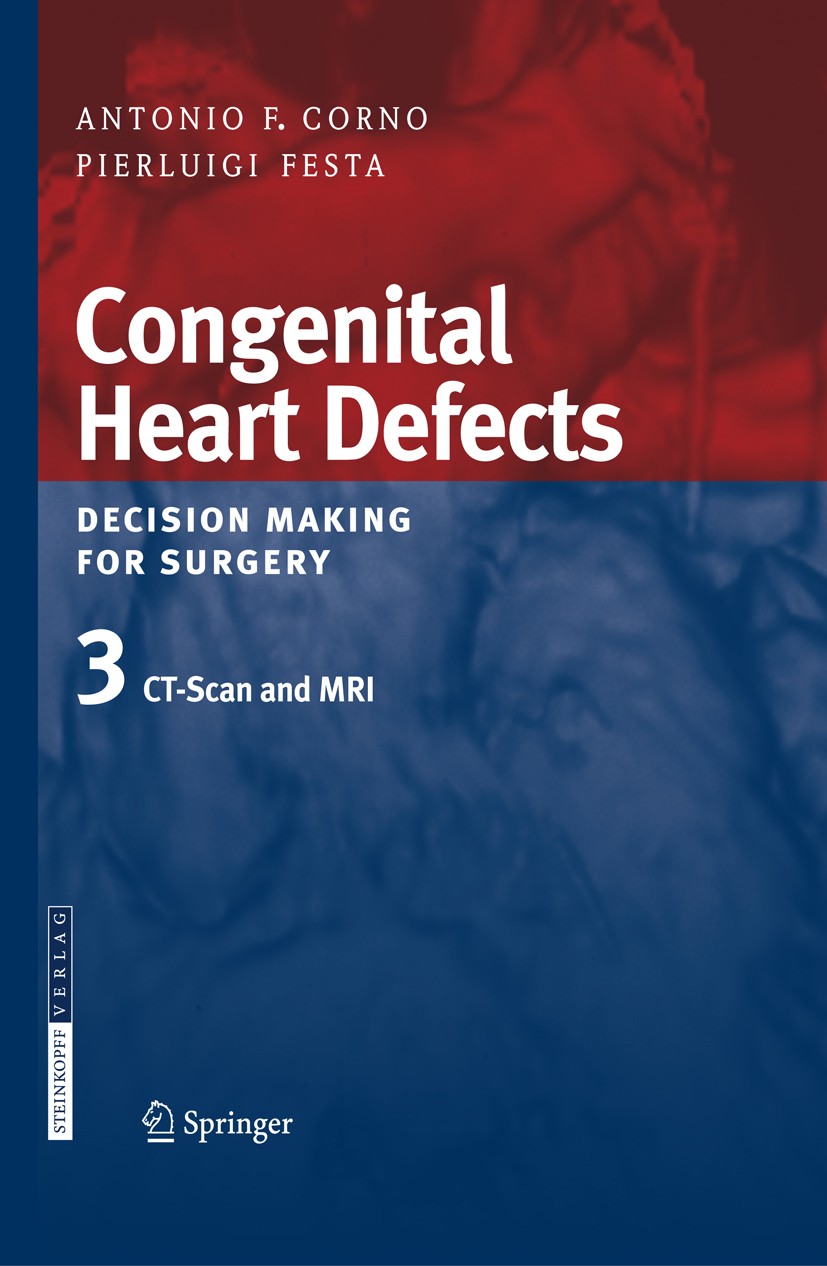 健康・医学 Surgery for congenital heart defects Surgery for Congenital Heart Defects: Stark, Jaroslav F., de