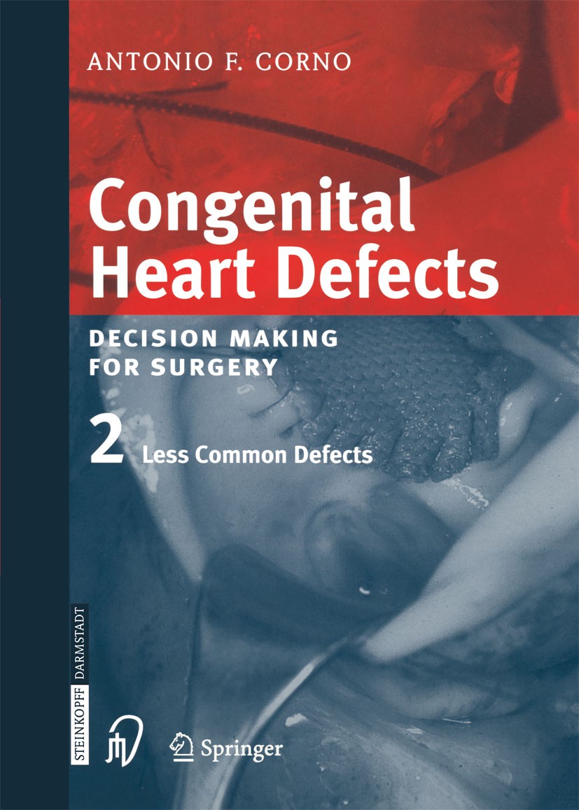 Congenital Heart Defects: Decision Making for Cardiac Surgery