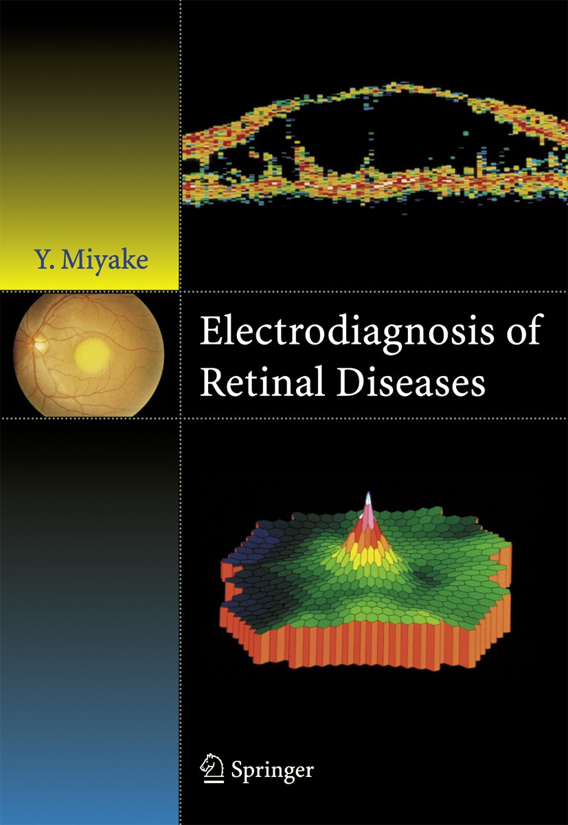 語学+参考書 Electrodiagnosis of retinal di Electrodiagnosis of Retinal Disease | SpringerLink