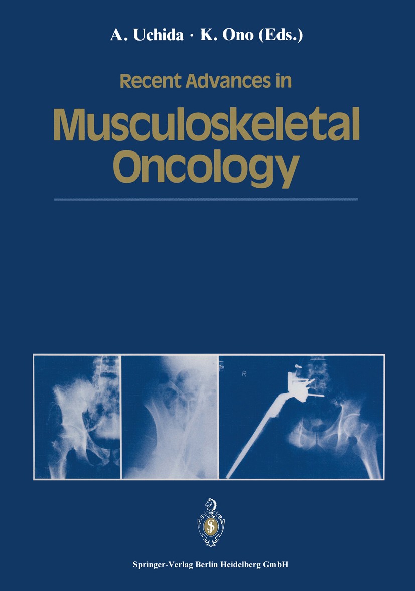 Recent Advances in Musculoskeletal Oncology: 9784431683667