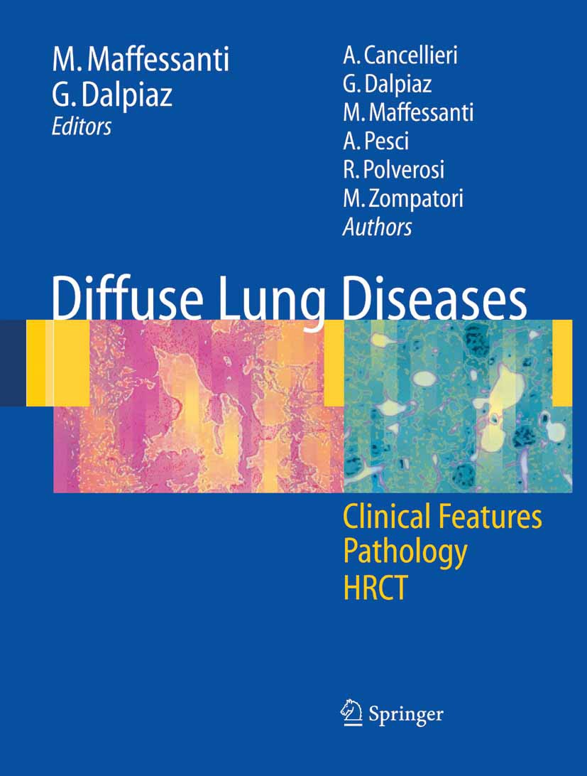 ファッションアイテム人気ランキング Clinical Diseases: Lung Diffuse Features, HRCT Pathology, 語学+参考書