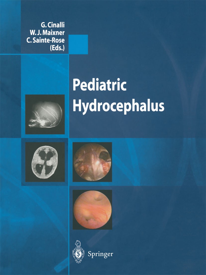 Classification and Definition of Hydrocephalus: Origin, Controversy, and  Assignment of the Terminology | SpringerLink