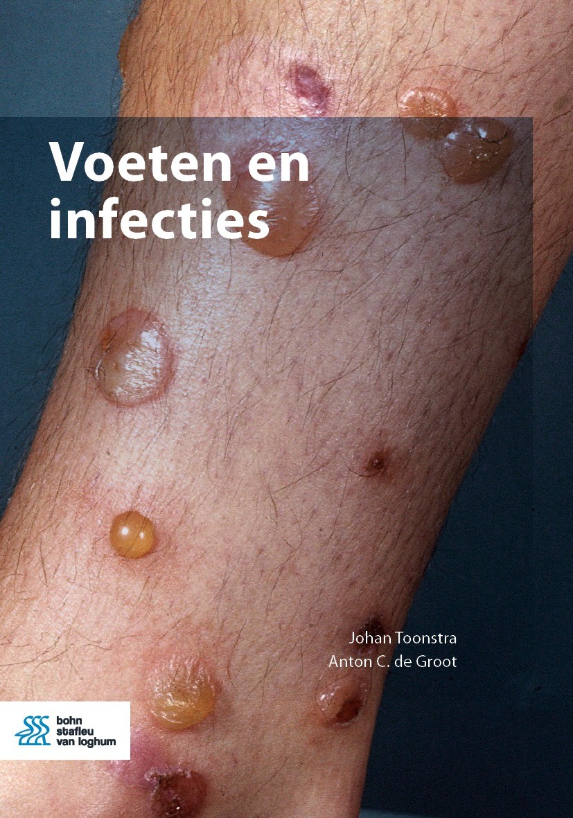 Huidziekten veroorzaakt door parasieten | SpringerLink
